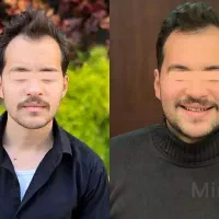 توی 20 روز صورتتو تپلی کن