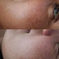 با فیشال...پوستی صاف و روشن به خودت هدیه بده