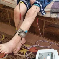 فیزیوتراپی سیار در مهاباد
