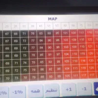 ریمپ و تیونینگ و تست موتور باطریسازی  امیر