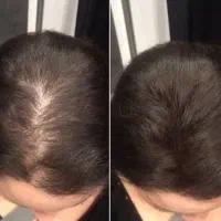 این اگهی برای توعه