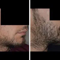 جذابیت مرد به ریششه