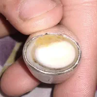 انگشتر عطف شرط اصلی خیلی قدیمی