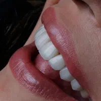 کاراموزدستیار دندانپزشک