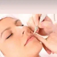 خدمات الکترولیز وآموزش رفع موهای زائد صورت