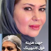 لیفت کامل صورت به روش فولیو بدون جراحی توسط پزشک