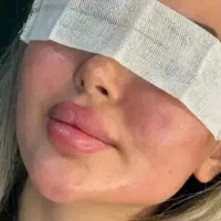 جشنواره بهاره ژل و بوتاکس به مدت محدود