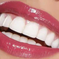 خدمات دندانپزشکی و ایمپلنت با تخفیف ویژه