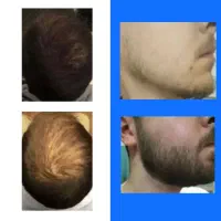 چهره مردانه، ریش و موی دلخواه