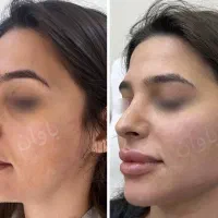 زیبایی.پی ارپی جوانسازی و ژل و بوتاکس پوست و مو