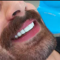 خدمات دندادن پزشکی