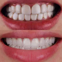 دندانپزشکی با ۲۰ درصد نقد و مابقی اقساط بلند مدت