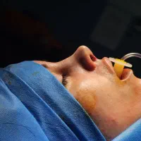 جراحی بینی دکتر اسدالله پور