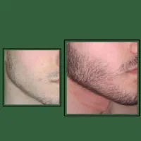 معجزه ریش و سیبیل