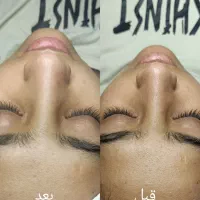 فیشیال تخصصی