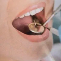 استخدام دستیار دندانپزشک