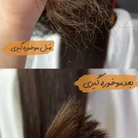 جشنواره موخوره گیری و کوتاهی لیزری