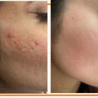 این پک تخصصی رو از دست نده