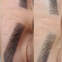 میکروبلیدینگ ابرو