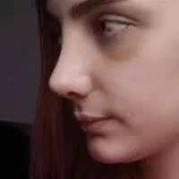بینیی|خدمات زیبایی و سلامت|دهدشت, |دیوار