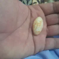 سنگ