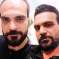کاشت مو به قیمت پارسال فول تراکم