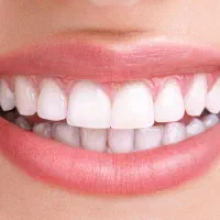 ساخت دندان مصنوعی به صورت خصوصی