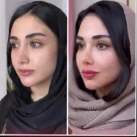 کلینیک تخصصی فرسیما/لیفت نخ/کانتورینگ/فیلر/بوتاکس