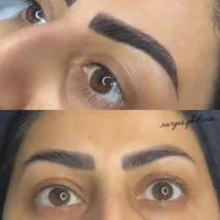 مدل میکروبلیدینگ