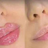 جشنواره فیلر لب تخصصی سبک M کیفیت عالی