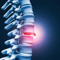 دیسک،سیاتیک و تنگی کانال نخاعی