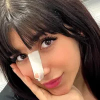 کاشت هیدن تخفیف ب مدت محدود
