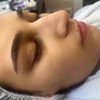 میکروبلیدینگ