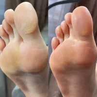 پدیکور و کفسابی تخصصی پاهای شما