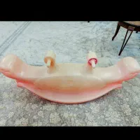 الاکلنک کودک