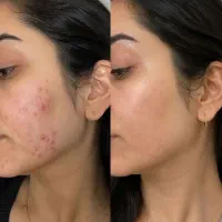 نمایندگی کرم ۱۵ کاره باما اصل خرید کنید