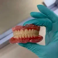 دندانسازی/لثه نرم/دندان مصنوعی/ژله ای اوردنچر/بیمه