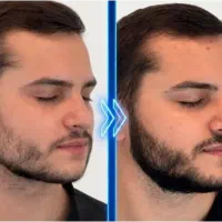 ریش پر تر چهره مردانه تر