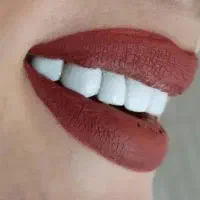 دست دندان ا ضمانت ده سال بی قیدوشرط