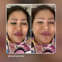فیشال وپاکسازی صورت
