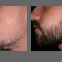چقد دیگه باید صبر کنی ریشات پرشه