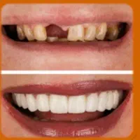 کلینیک دندانپزشکی با اقساط 2 ماهه چکی