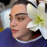 جشنواره کاشت مو و ابرو با و بدون جراحی