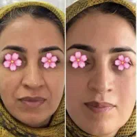کرم بازسازی کننده پوست