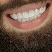 ونیر اصلی