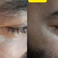 معجزه از بین بردن لک ‌‌‌،چین ،چرک برند لوزان سویس