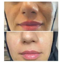 پک اقتصادی بیوممتیک/معجزه ای برای پوست