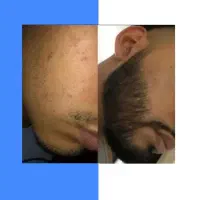 اگه ریش نداری این آگهی ماله توعه