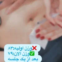 لاغری تضمینی و قطعی توسط خانوم دکتر مهیار یوسف پور