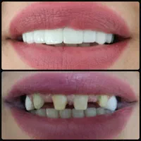 دندانپزشکی افسریه